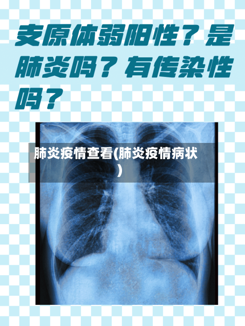 肺炎疫情查看(肺炎疫情病状)-第2张图片